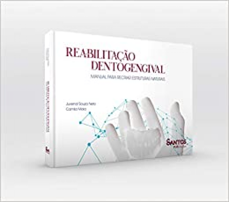 Reabilitação Dentogengival - Manual para Recriar Estruturas Naturais