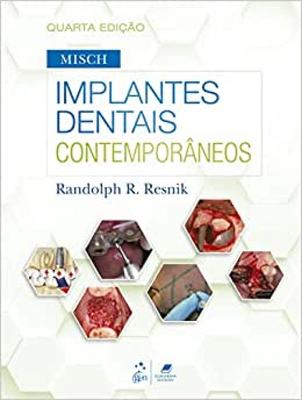 Misch - Implantes Dentais Contemporâneos