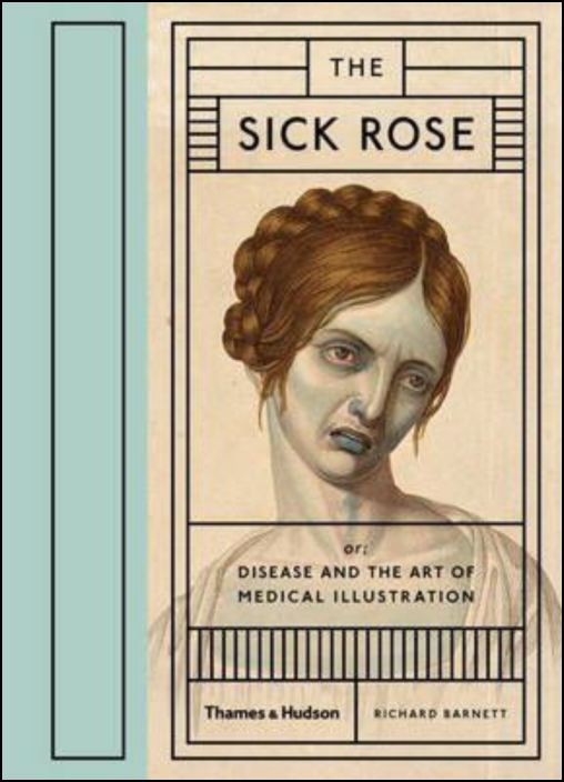 The Sick Rose