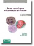 Avances en lupus eritematoso sistémico