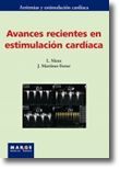 Avances recientes en estimulación cardíaca