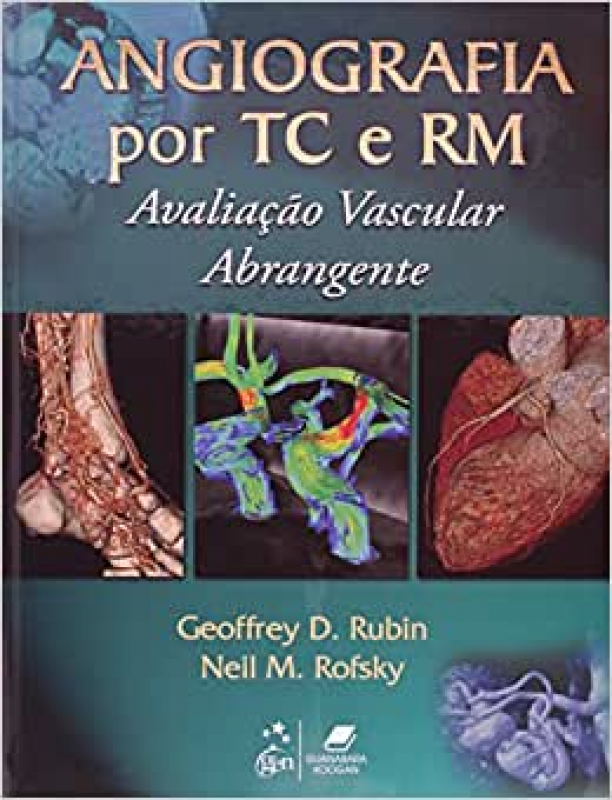 Angiografia por TC e RM - Avaliação Vascular Abrangente