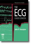 150 Ecg Casos Clínicos
