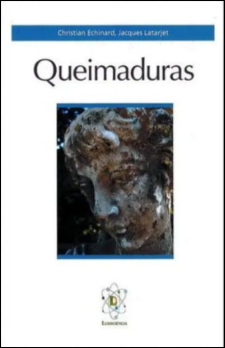 Queimaduras
