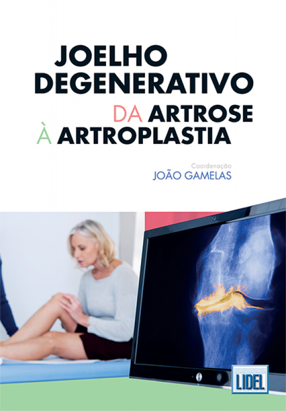 Joelho Degenerativo - da Artrose à Artroplastia